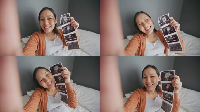 一位孕妇在视频通话中展示了超声图像