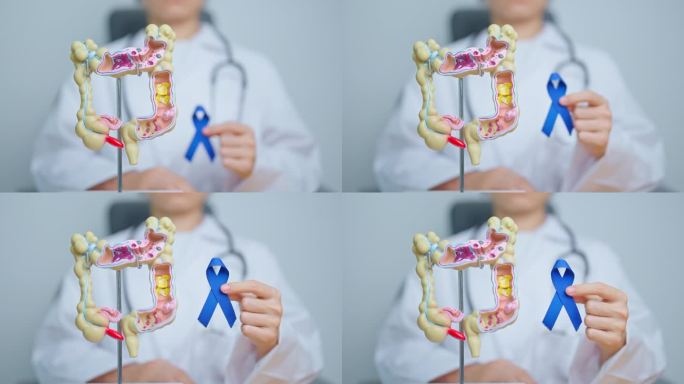 医生拿着带有人体结肠解剖模型的蓝丝带。三月大肠癌宣传月，结肠疾病，大肠，溃疡性结肠炎，消化系统和健康