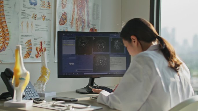 女医生看着电脑屏幕，分析大脑扫描核磁共振图像