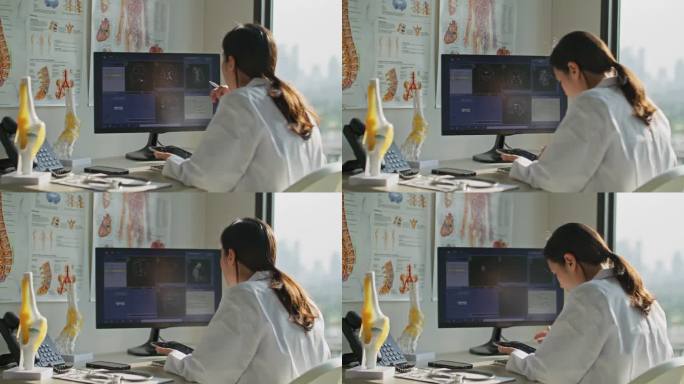 女医生看着电脑屏幕，分析大脑扫描核磁共振图像