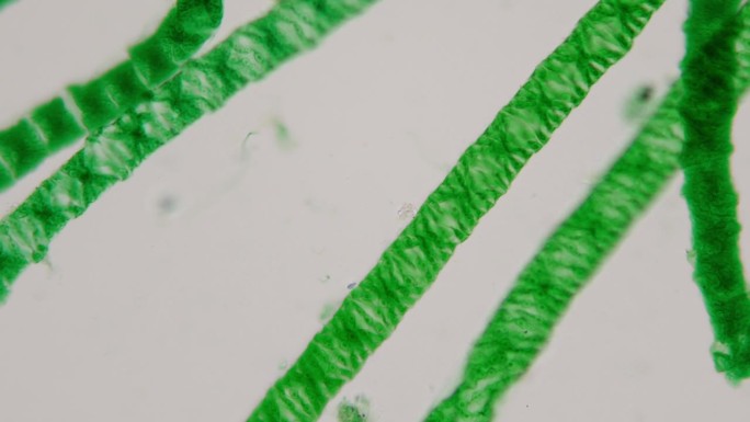 显微镜下的水绵，常见的名字包括水丝、美人鱼的头发和毯草。叶绿体螺旋。放大400倍。淡水水体的藻类。水