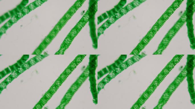 显微镜下的水绵，常见的名字包括水丝、美人鱼的头发和毯草。叶绿体螺旋。放大400倍。淡水水体的藻类。水