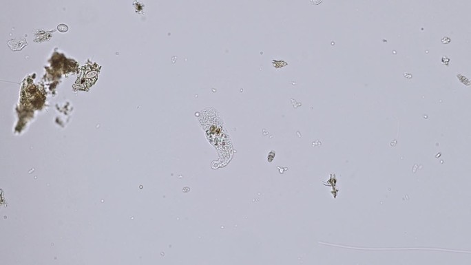 变形虫(单细胞变形虫)在显微镜下的运动-光学显微镜x200倍放大