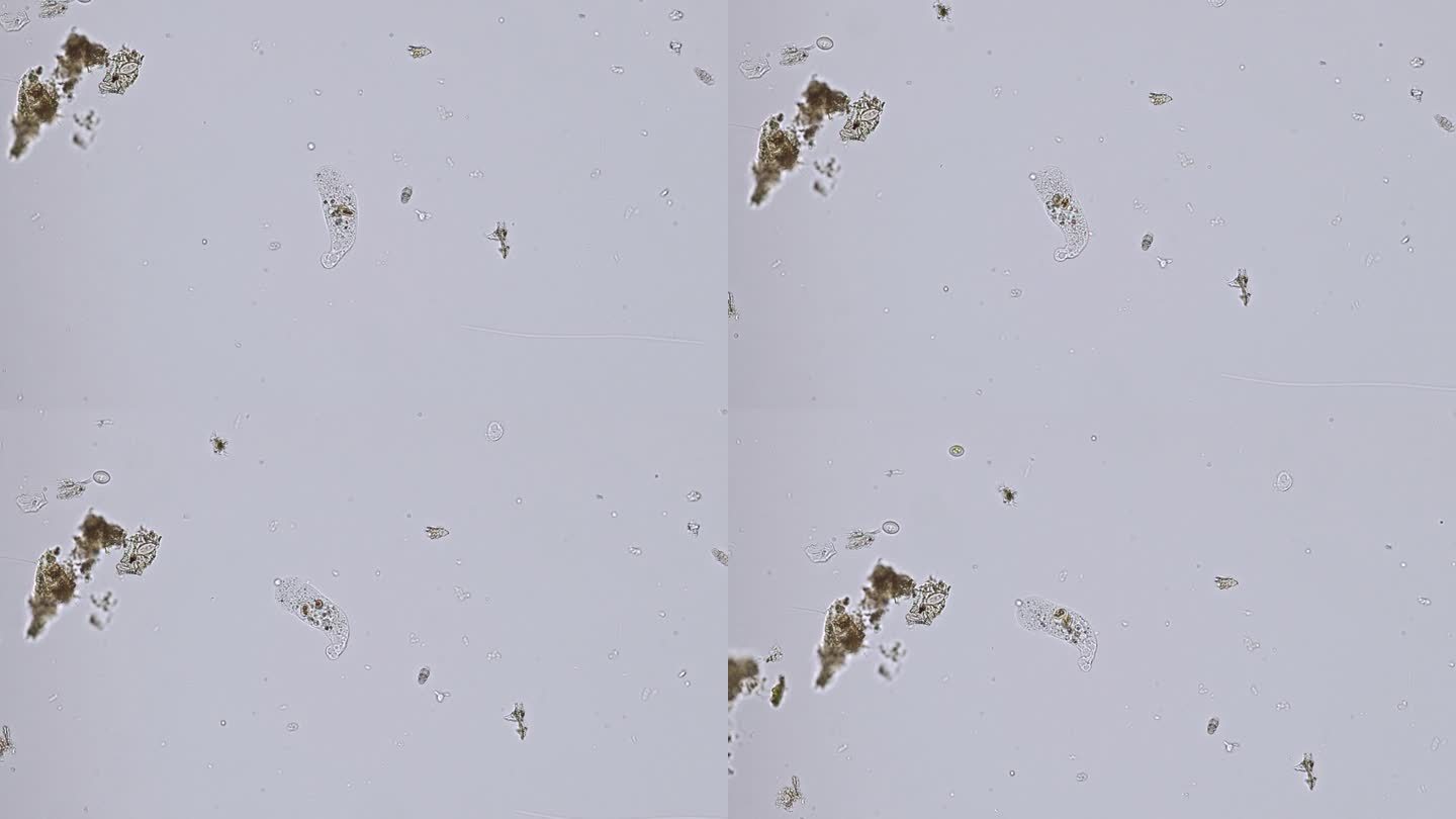 变形虫(单细胞变形虫)在显微镜下的运动-光学显微镜x200倍放大