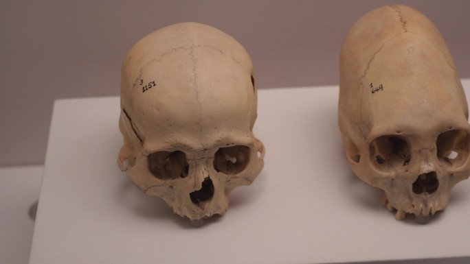 秘鲁印加博物馆印加帝国颅骨