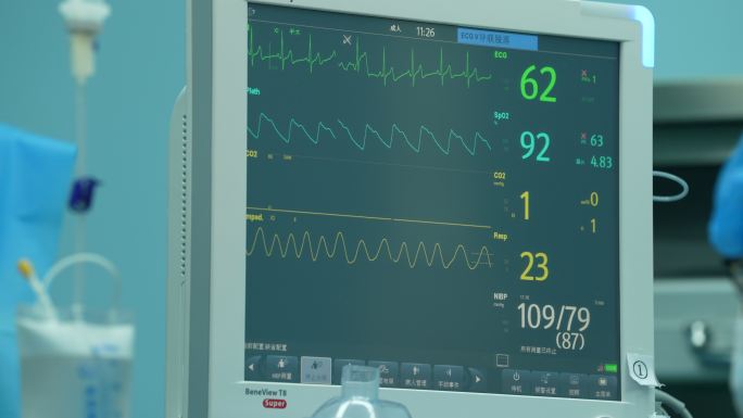 4k手术室心电监护仪器