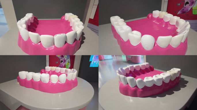 科技馆牙齿模型