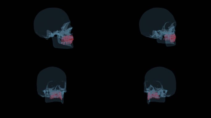 骷髅牙齿 特写咬合问题口腔科镶牙假牙9