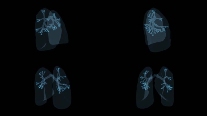 肺部感染肺炎肺结核肺病肺癌炎症扩散结节9
