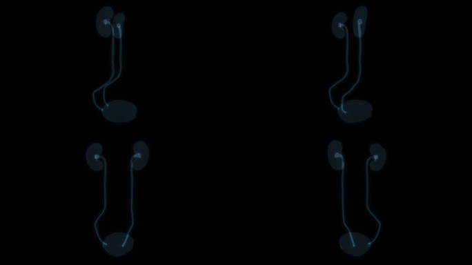 肾脏膀胱 肾小球肾小管尿道输尿管泌尿9