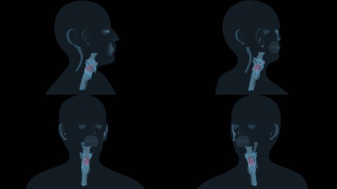 咽内部 咽喉喉咙喉喉头头耳鼻喉科五官科9