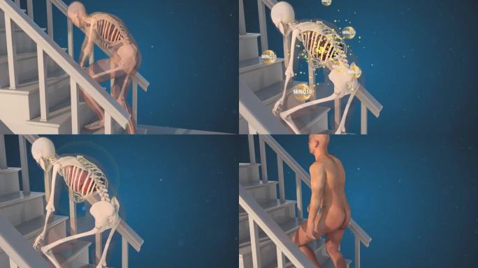 【三维医疗模型动画】上楼梯气喘横版加音效