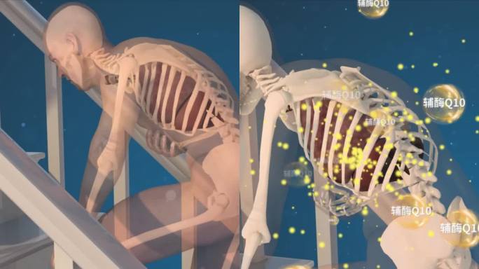 【三维医疗模型动画】上楼梯气喘竖版加音效
