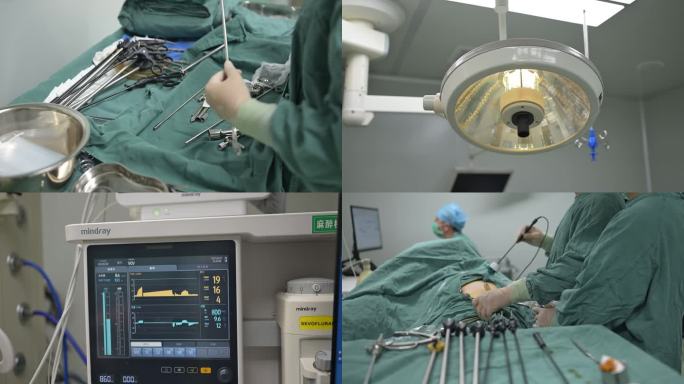 腹腔镜手术治疗医院手术室医生做手术