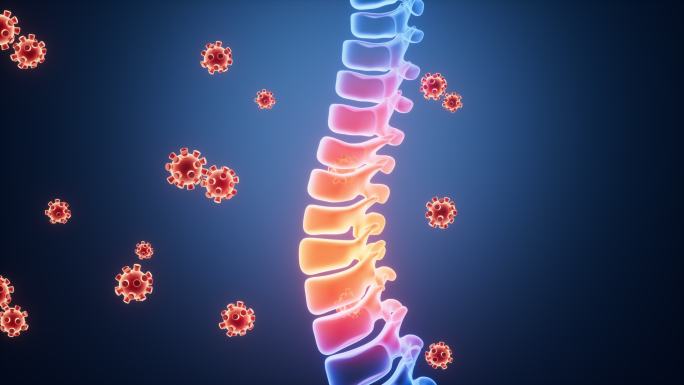人类脊椎脊柱发炎感染和病毒动画