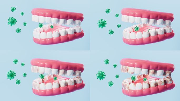 病毒感染牙齿口腔健康动画
