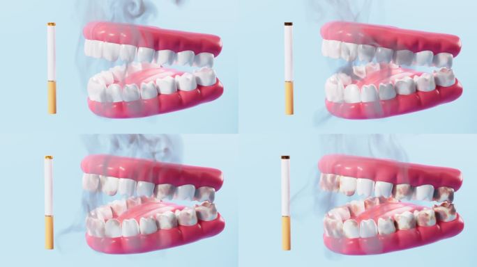 吸烟与牙齿口腔疾病概念动画