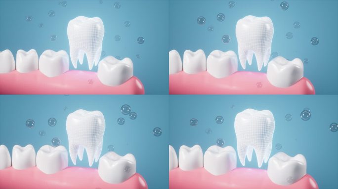 人类牙齿修复假牙植入牙齿动画