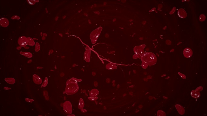 红细胞汇聚形成血栓血块血管堵塞