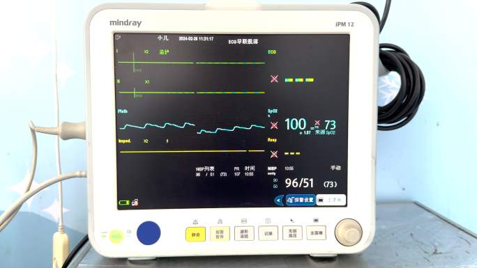 监护仪器心电图波形图