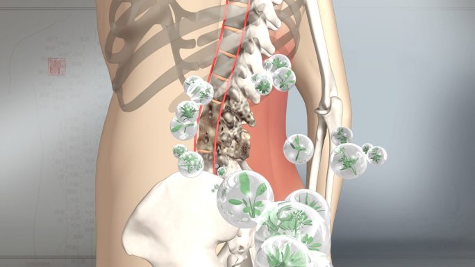 修复骨骼 腰间盘突出 骨质增生 腰突