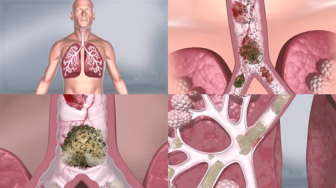 人体肺肺 泡健康 肺部呼 吸清 理清肺