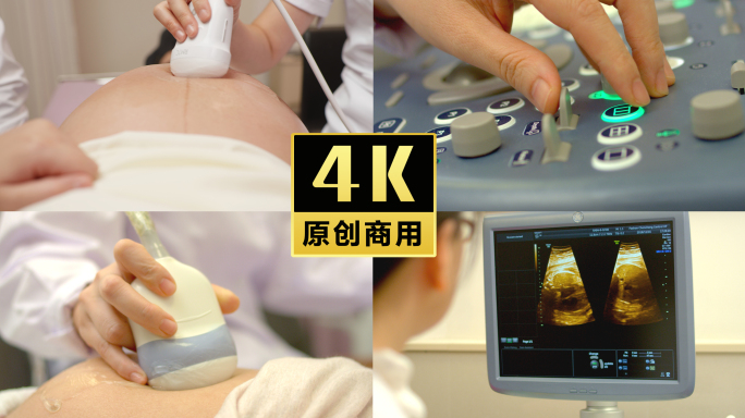 医院孕妇检查超声波B超影像
