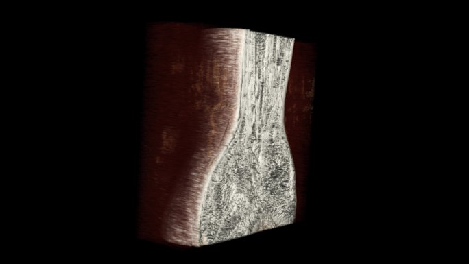 腕部核磁 手腕MRI影像 三维切片 5