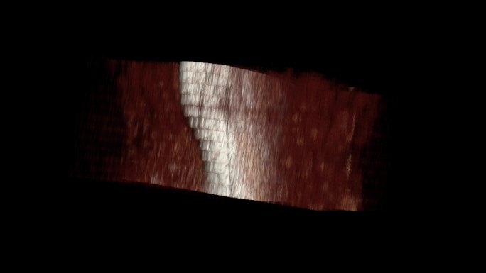 腕部核磁 手腕MRI影像 三维切片 7