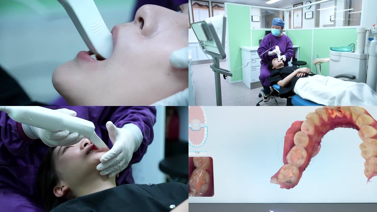 4K美女接受口腔扫描仪3D建模