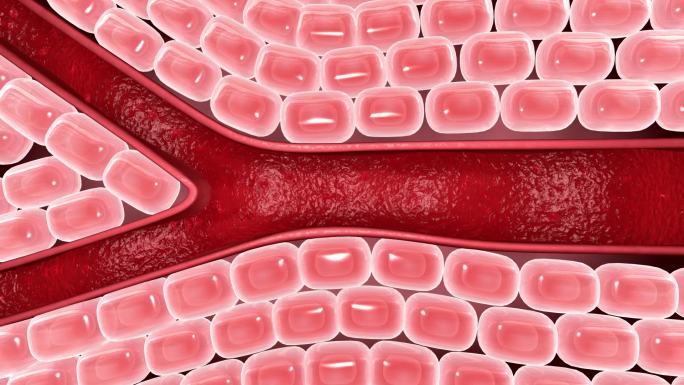 管疏通 血栓粘稠 栓塞 血液 血管堵塞