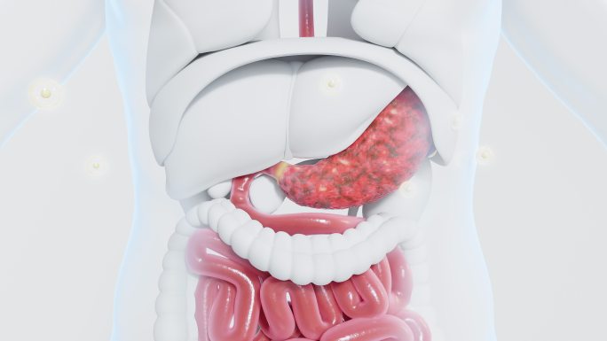 胃炎胃痛胃癌症肠道内脏病变修复医疗