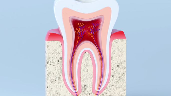 两组龋齿牙齿结构蛀牙动画