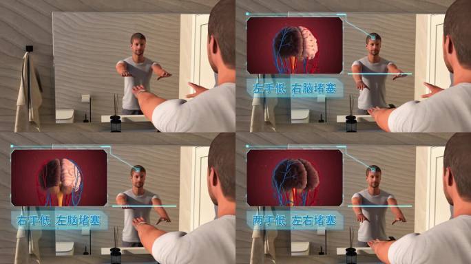 【医疗类三维动画】对镜自检脑梗横版加音效