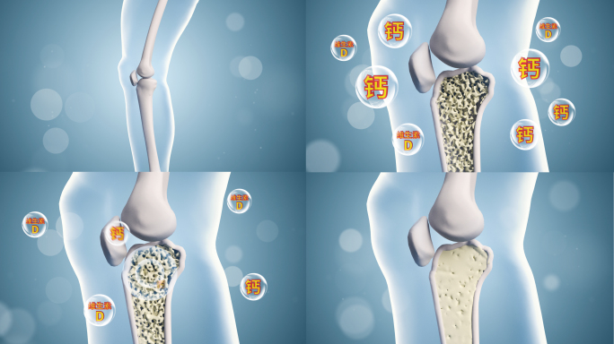 治疗骨质疏松 骨密度变化3D动画