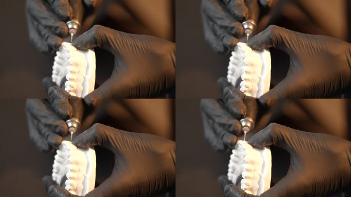 牙齿牙医修牙义齿打磨牙齿假牙视频
