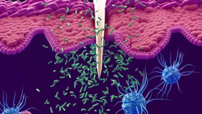 免疫系统:巨噬细胞、树突状细胞和白细胞抵御细菌感染和病原体