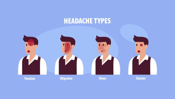 四种类型的头痛对患者头部不同区域的卡通动画
