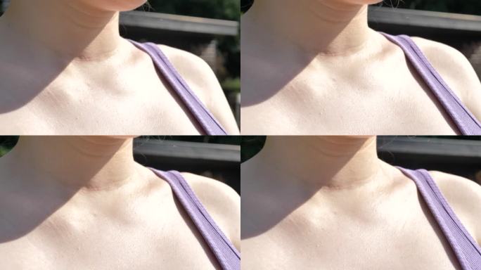 高加索女性喉部甲状腺切除疤痕