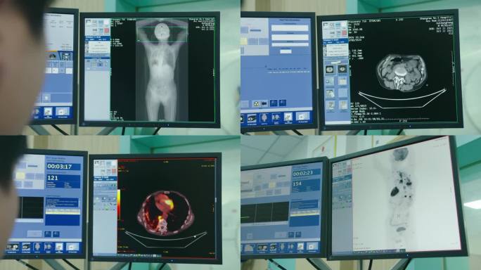 4kPETCT派特CT检查 影像检查