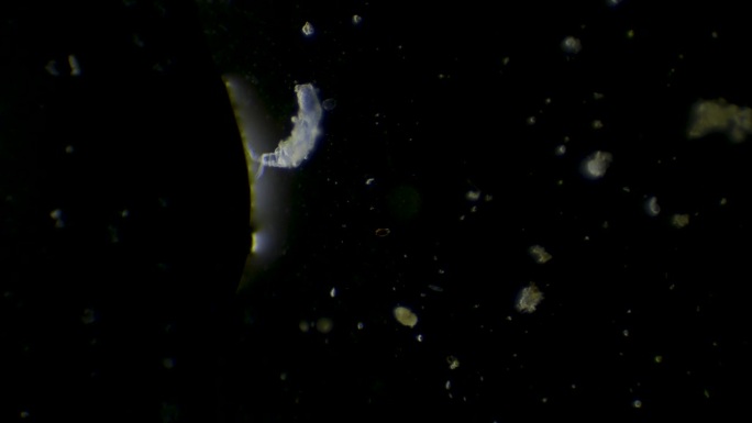 淡水轮虫鞭毛虫(trichotria tetractis)在显微镜下的两个不同角度