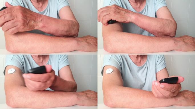 第五阶段。用血糖仪测量糖尿病患者的血糖水平。