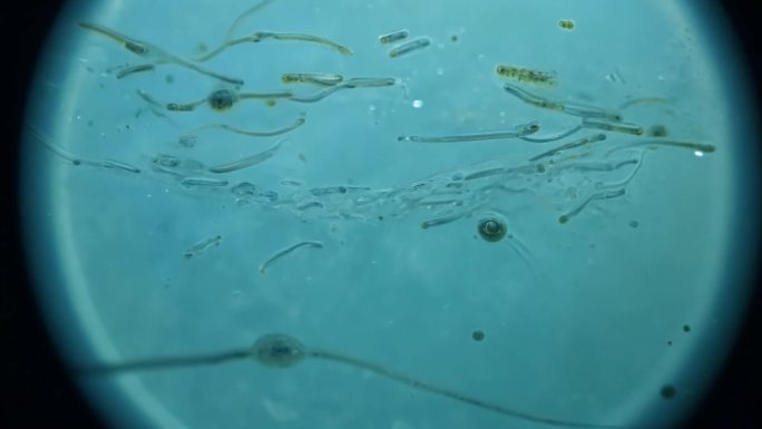 显微镜观测 医学研究  微观世界