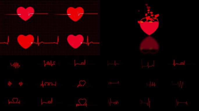 平面心跳动画 心电图 通道素材