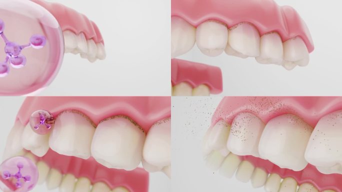 清洁牙齿和牙菌斑的牙膏和漱口水