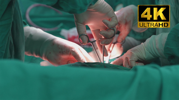 4K实拍 手术 手术器械 做手术过程
