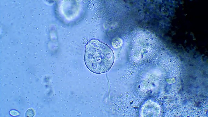 微生物Vorticella，放大40倍