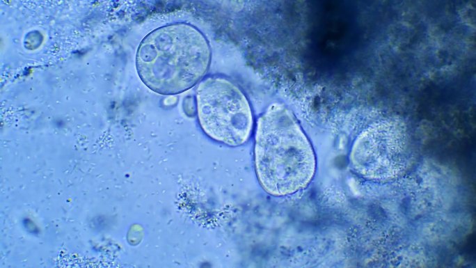 微生物Vorticella，放大40倍