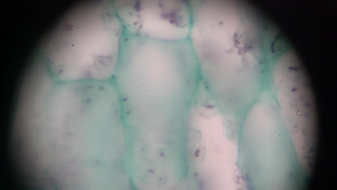蕨类茎纵切
光镜下放大不同区域