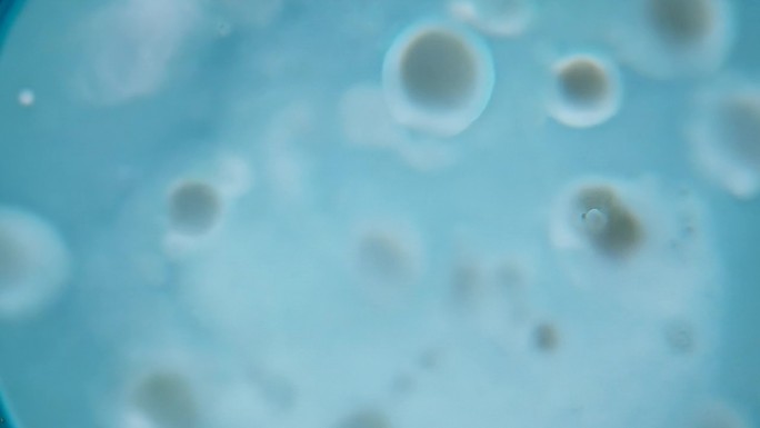 显微镜下酵母菌